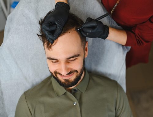 Tratamientos según el tipo de pérdida capilar