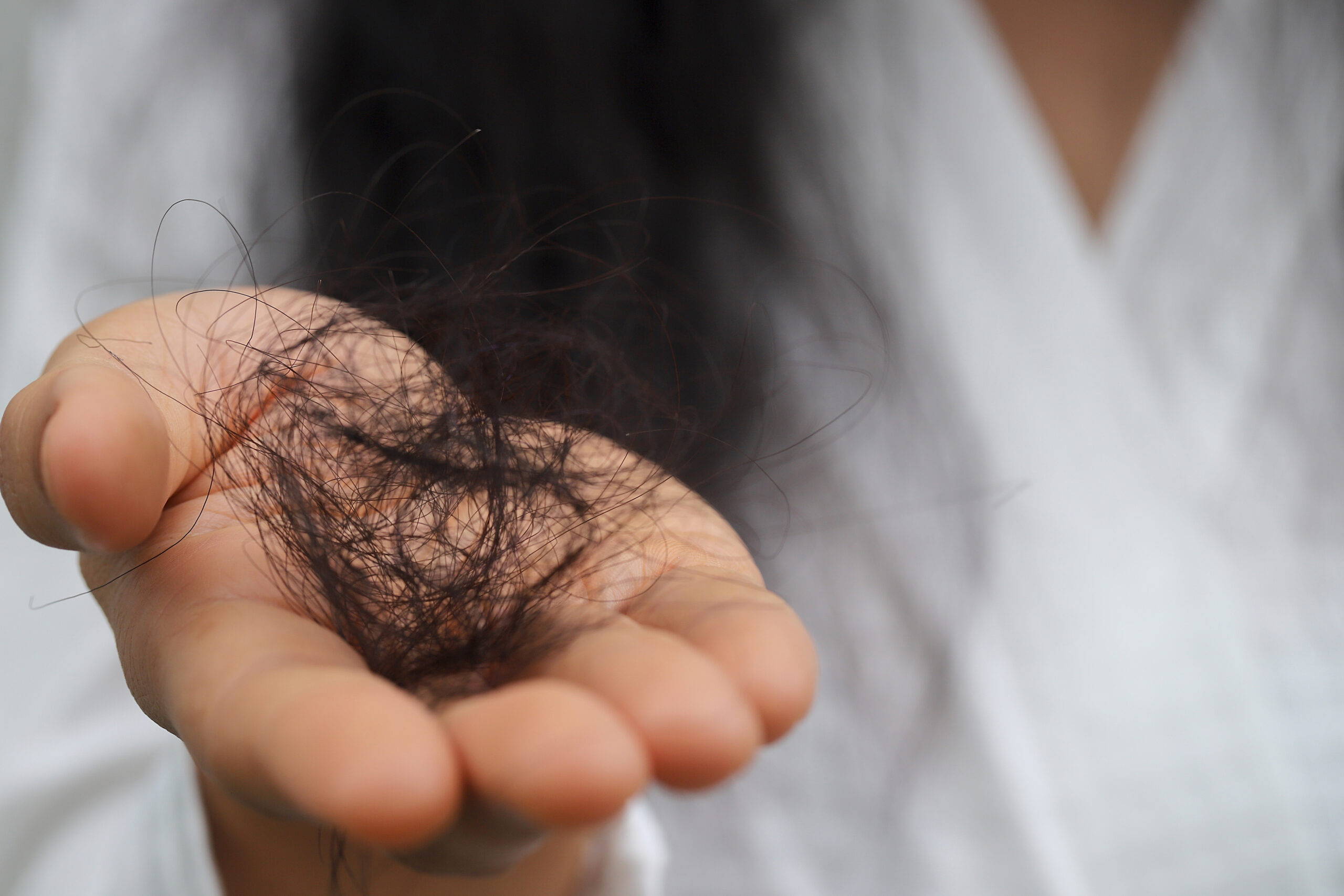 Woman with hair loss dryness and frizziness
